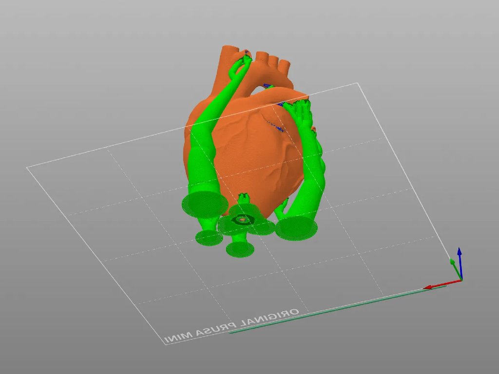 Анатомическое сердце